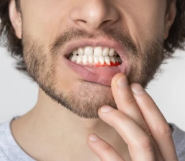 Gengiva inflamada e dolorida: Descubra a possível causa e tratamento!